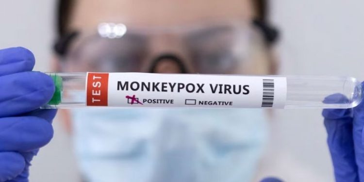 İngiltere'de 104 maymun çiçeği vakası daha tespit edildi