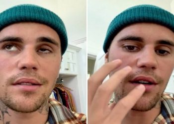 Şarkıcı Justin Bieber kısmi yüz felci geçirdi