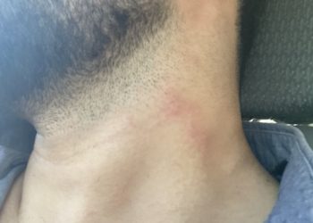 Adana’da gazeteciler alıkonularak, darp edildi