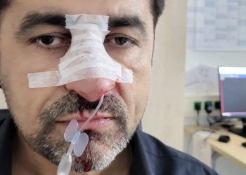 Almanya’da Türk kökenli siyasetçiye ırkçı saldırı
