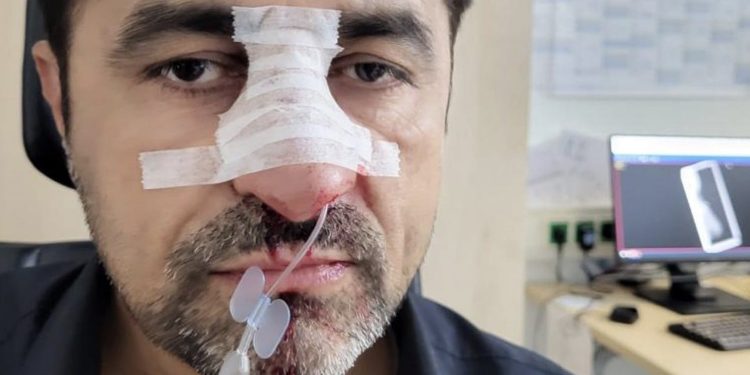 Almanya’da Türk kökenli siyasetçiye ırkçı saldırı