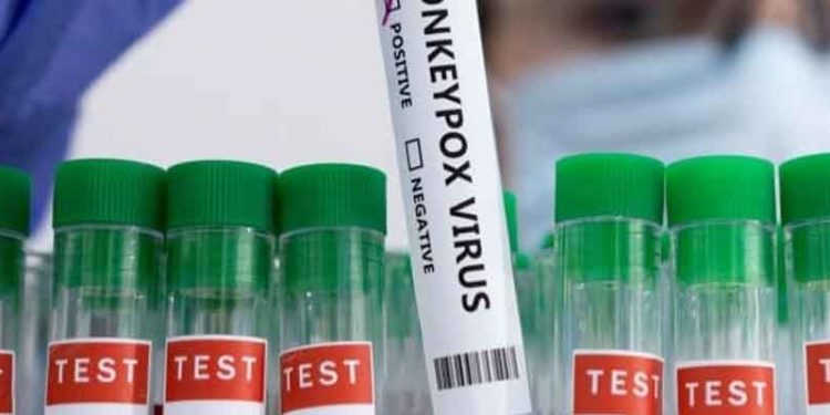 Avrupa ve Latin Amerika’da maymun çiçeğinden ilk ölümler