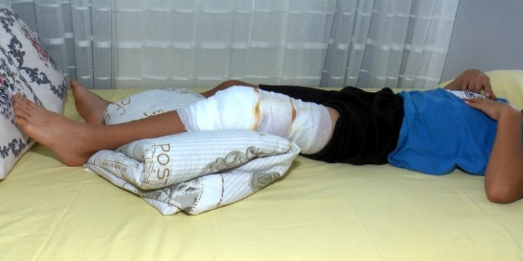 Bahçelievler'de parkta oynayan çocuğa pitbull saldırdı