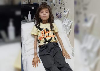 Çöp evde bulunan çocuk koruma altına alındı, sağlık durumu iyi