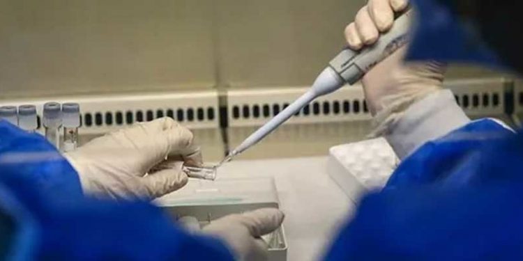 DSÖ: Dünyada binin üzerinde gizemli hepatit vakası var