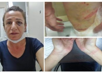Köpekle işkence eden polise dava ‘basit yaralama’dan açıldı