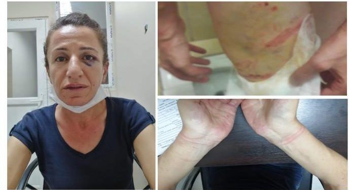 Köpekle işkence eden polise dava ‘basit yaralama’dan açıldı