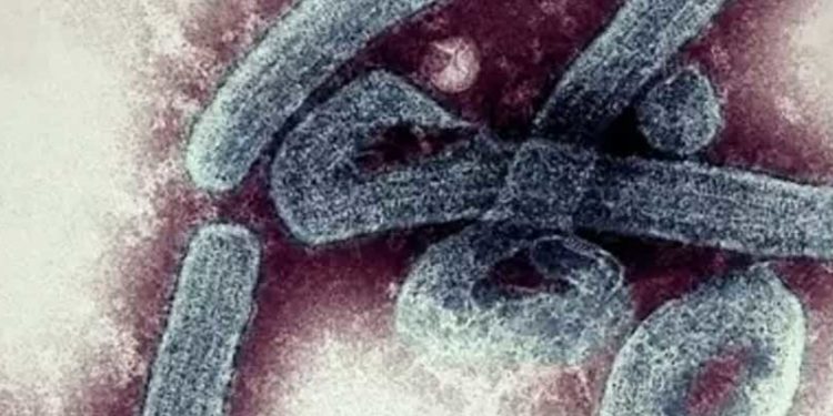 Marburg virüsü: Gana'da 2 kişi hayatını kaybetti, temaslı 98 kişi karantinaya alındı