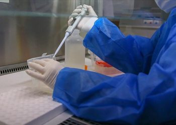 Rusya'da ilk maymun çiçeği virüsü vakası tespit edildi