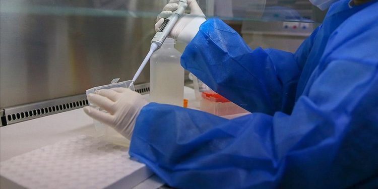 Rusya'da ilk maymun çiçeği virüsü vakası tespit edildi