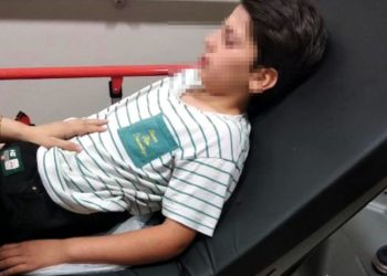 'Ses bombası yapımı' videosu izleyip evde deneyen çocuk, 2 gözünden yaralandı