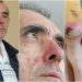 4. evre kanser hastası Ahmet Zeki Özkan tahliye edildi