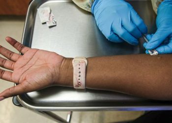 ABD'de onur etkinlikleri için 50 bin doz maymun çiçeği aşısı ayrıldı