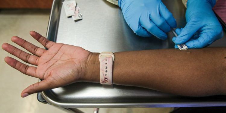 ABD'de onur etkinlikleri için 50 bin doz maymun çiçeği aşısı ayrıldı