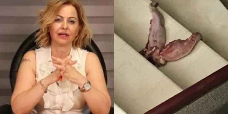 Aşı karşıtları, Prof. Dr. Şenol'un ofisinin önünde 'dana dili' bıraktı