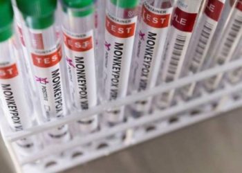 Avrupa'da maymun &ccedil;i&ccedil;eği vaka sayısı 20 bine yaklaştı