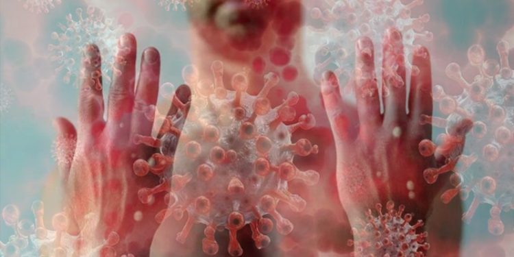 Bir kişide 3 hastalık birden: Maymun çiçeği, Covid-19 ve HIV