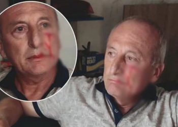 CHP’li Yarbaşı Belediye Başkanı Mustafa Kaynar'a saldırı