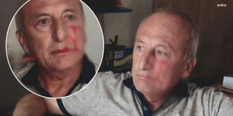 CHP’li Yarbaşı Belediye Başkanı Mustafa Kaynar'a saldırı