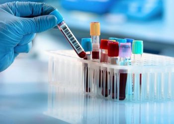 İspanya’da 2 çocuk gizemli hepatitten hayatını kaybetti