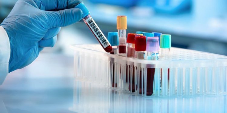 İspanya’da 2 çocuk gizemli hepatitten hayatını kaybetti