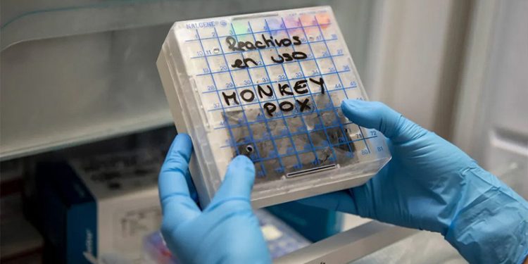 İspanya'da maymun çiçeği vaka sayısı 5 bini geçti