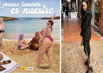 İspanya'nın beden olumlama kampanyasında bir skandal daha: Modelin protez bacağı değiştirilmiş