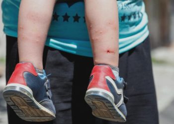İstanbul'da 'Aedes' türü sivrisinek tehdidi