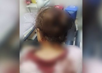 Mardin'de koruculardan köylülere saldırı: 5 yaralı