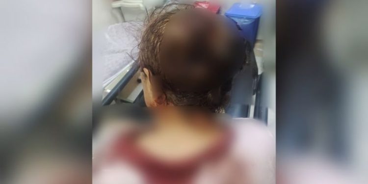 Mardin'de koruculardan köylülere saldırı: 5 yaralı