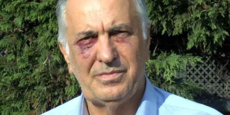 Saldırıya uğrayan Kartal Cemevi Başkanı: Ankara'nın devamı olduğunu düşünüyorum