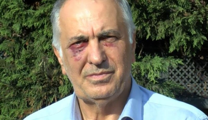 Saldırıya uğrayan Kartal Cemevi Başkanı: Ankara'nın devamı olduğunu düşünüyorum