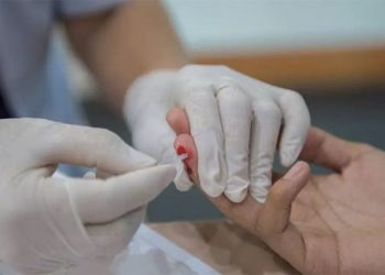 Türkiye’de son üç yılda HIV tanısı alan kişilerin sayısı 10 bine ulaştı