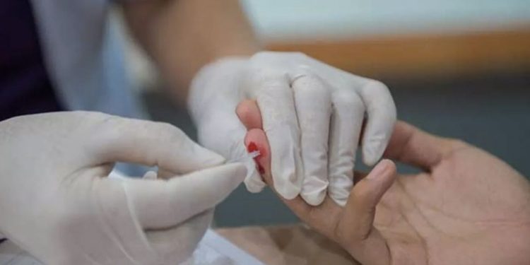 Türkiye’de son üç yılda HIV tanısı alan kişilerin sayısı 10 bine ulaştı