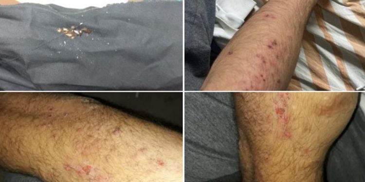 YDA GROUP’un kampındaki işçiler tahtakurulu yataklarda kalıyor!