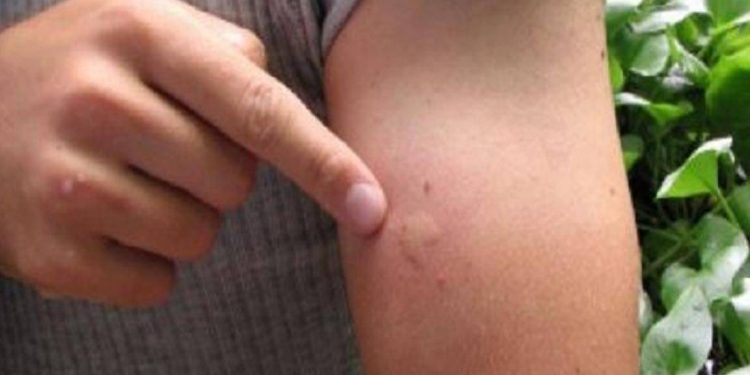 Yunanistan'da Batı Nil Virüsü'nden 11 kişi hayatını kaybetti