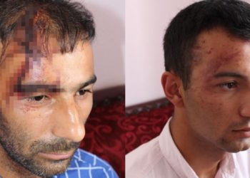 Aydın’daki ırkçı saldırıya suç duyurusu