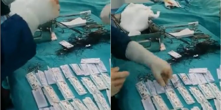 Adıyaman’da apandisit ameliyatında çürük ip skandalı: 67 ipliğin tamamı çürük çıktı