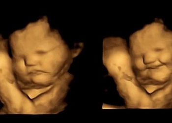 Araştırma: Anne karnındaki bebekler anneleri havuç yiyince gülümsedi