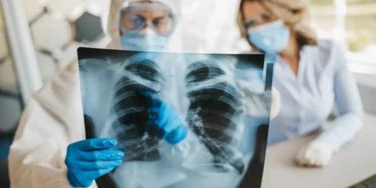 Arjantin'de 4 kişiyi öldüren gizemli zatürre: Lejyoner hastalığı olduğu açıklandı