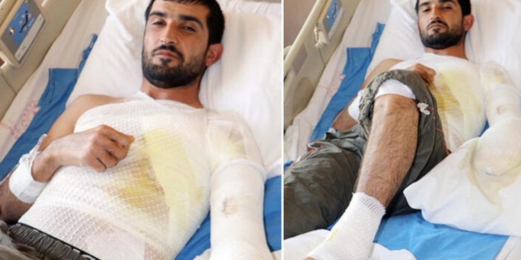 Epilepsi nöbeti geçirirken, kaynayan çorba kazanına düştü