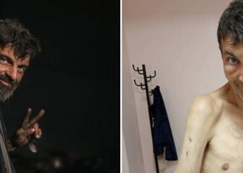 Esir takasında Rusya'nın iade ettiği Ukraynalı askerin değişimi dehşete düşürdü: Kolları kırıldı, zayıf düştü