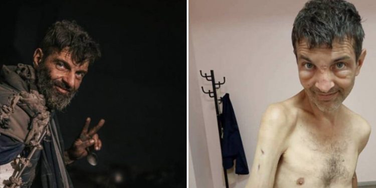 Esir takasında Rusya'nın iade ettiği Ukraynalı askerin değişimi dehşete düşürdü: Kolları kırıldı, zayıf düştü