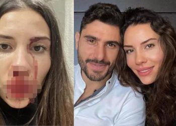 Futbolcu Özer Hurmacı'ya eşini darp etmekten ceza