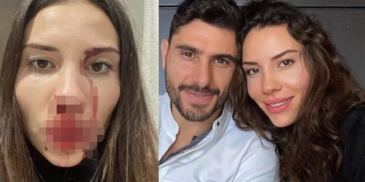 Futbolcu Özer Hurmacı'ya eşini darp etmekten ceza