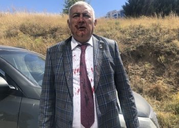 ‘Ümit Özdağ, Zafer Partisi’nden istifa eden kurucular kurulu üyesini dövdürttü’ iddiası
