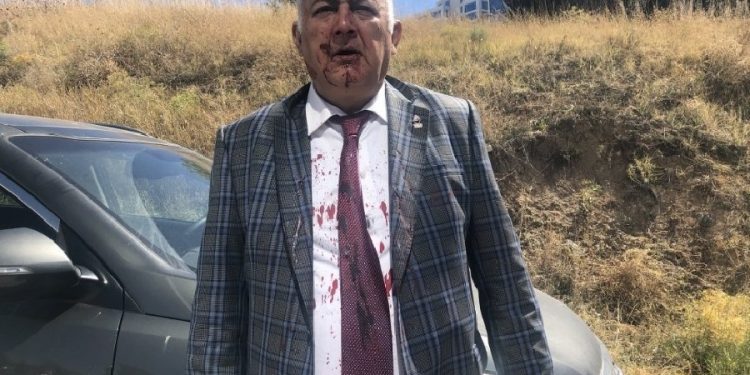 ‘Ümit Özdağ, Zafer Partisi’nden istifa eden kurucular kurulu üyesini dövdürttü’ iddiası