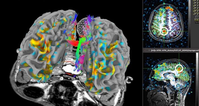Akıl okuyan teknolojiler ve insan beyni
