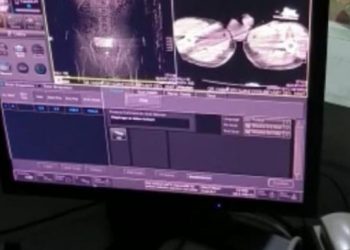 Bazid’de uyuşturucudan 4 kişi tutuklandı