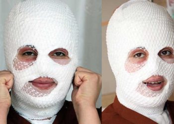 Düdüklü tencere patladı, yüzünde yanıklar oluştu